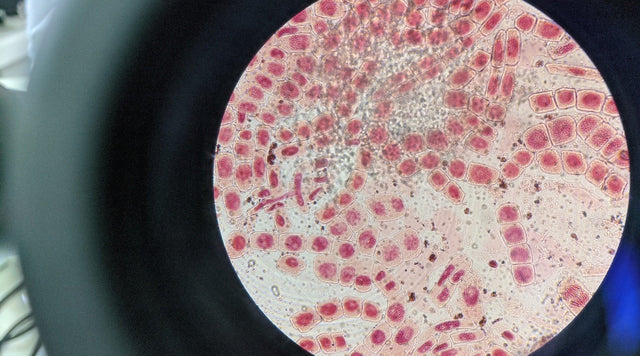 The Power of Cellular Recycling: How Autophagy Supports Healthy Ageing
